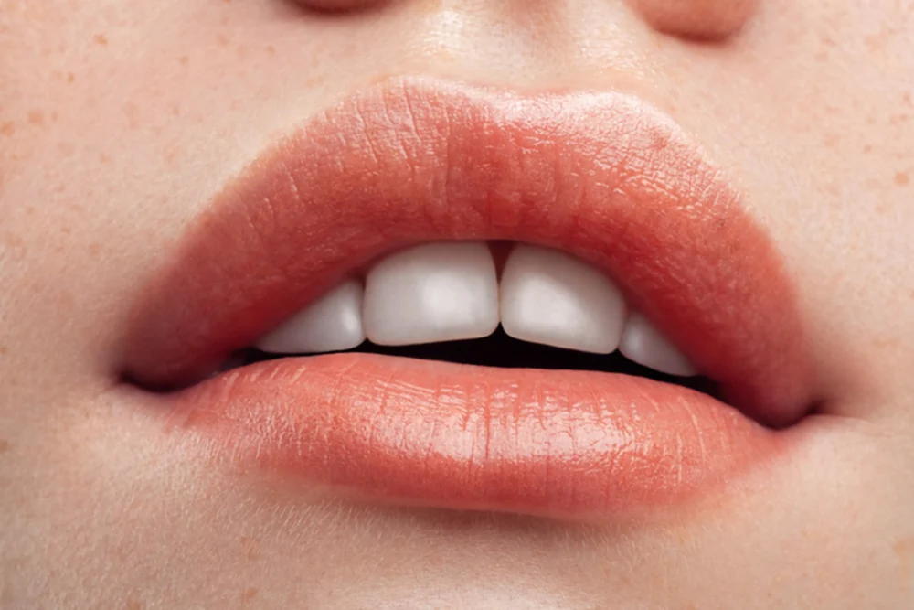 Sensual Kiss (Aumento De Labios)